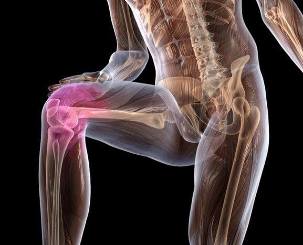 Φλεγμονή της άρθρωσης του γόνατος με οστεοαρθρίτιδα