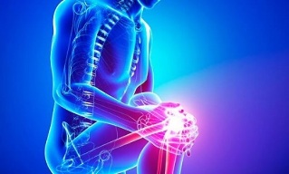 Στάδια της οστεοαρθρίτιδας της άρθρωσης του γόνατος