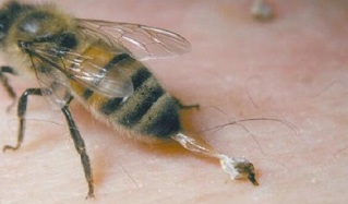 Θεραπεία της οστεοαρθρίτιδας του ισχίου από τις μέλισσες